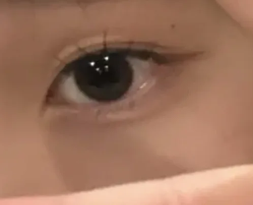 1週間たったあたりから見えづらかった、