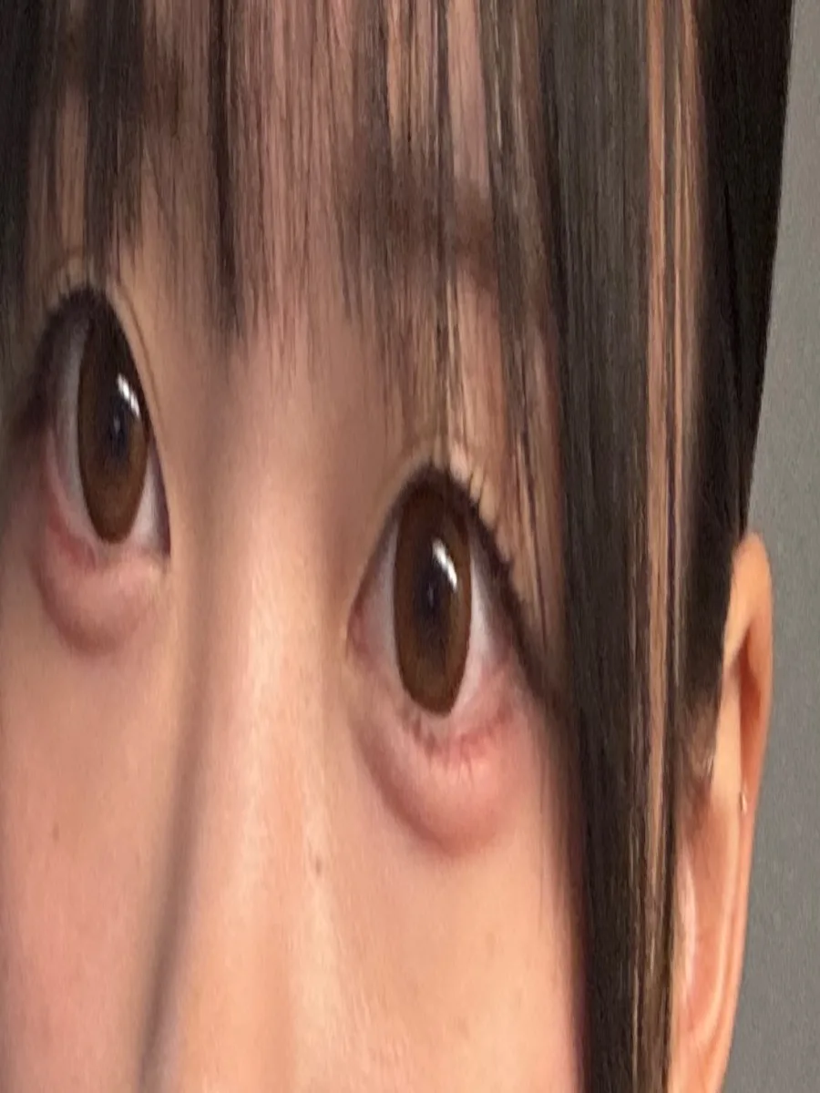 Treatee Treatee にくじゃがの着画・着用レビュー写真 by もみじ （2/2）